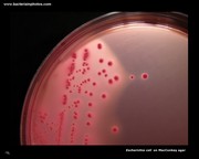 escherichia coli colonies on MacConkey agar